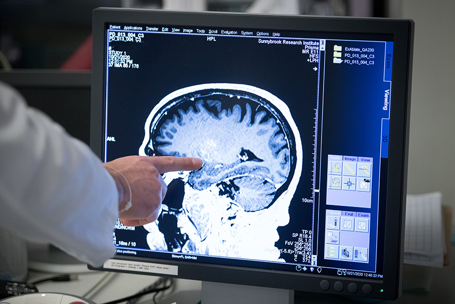 Someone pointing at a computer screen with a brain MRI on it