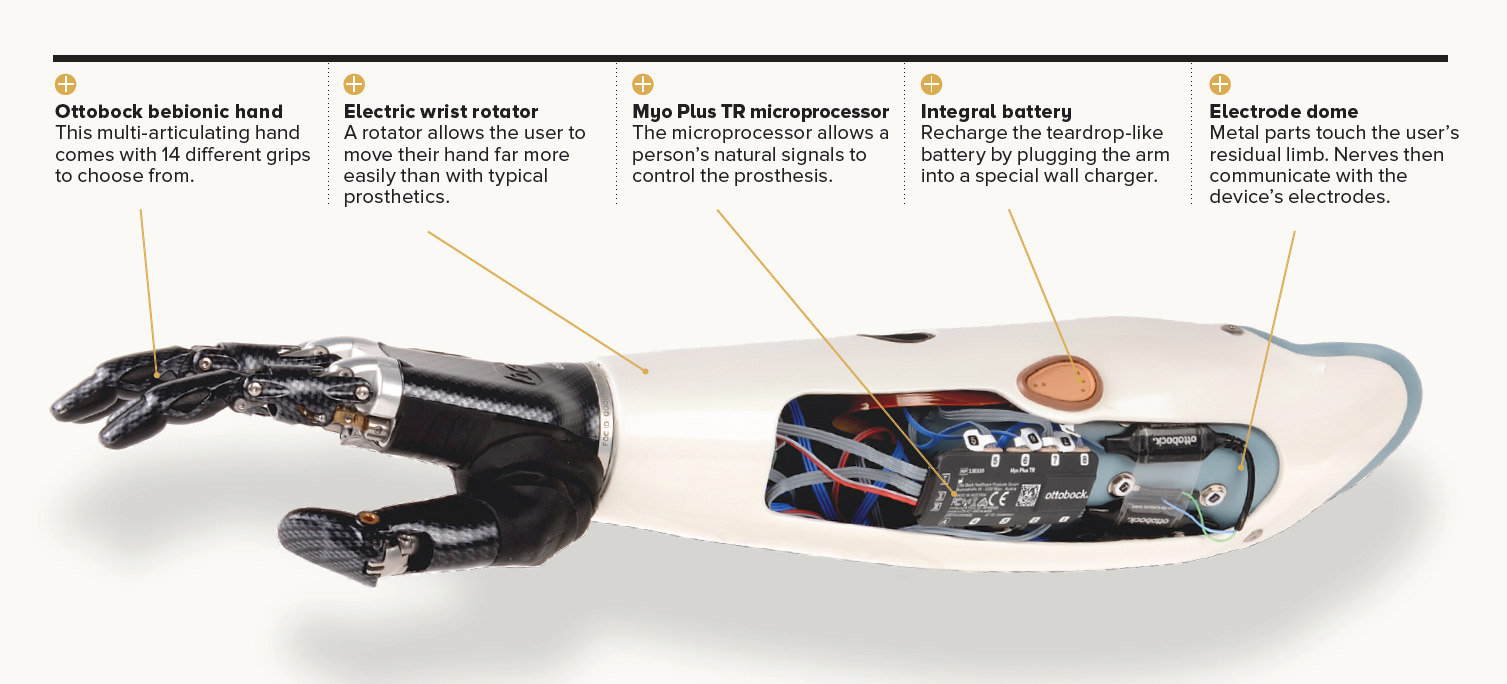 graphic showing the Ottobock bebionic hand with text explaining the different components of the hand - text as follows; Ottobock bebionic hand; this multi-articulating hand comes with 14 different grips to choose from.  Electric wrist rotator; a rotator allows the user to move their hand far more easily than with typical prosthetics.   Myo Plus TR microprocessor; the microprocessor allows a person’s natural signals to control the prosthesis.   Integral battery; recharge the teardrop-like battery by plugging the arm into a special wall charger.  Electrode dome; metal parts touch the user’s residual limb. Nerves then communicate with the device’s electrodes.